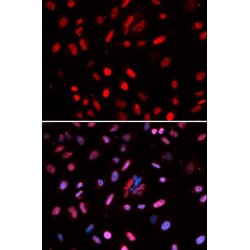 DNA Polymerase Delta 1, Catalytic Subunit (POLD1) Antibody