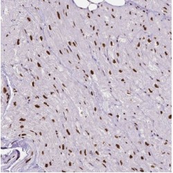 DNA Polymerase Delta 1, Catalytic Subunit (POLD1) Antibody