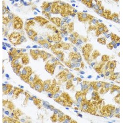 Polymerase DNA Directed Gamma 2 (POLG2) Antibody