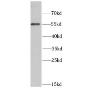 WB analysis of COLO 320 cells, using POLG2 antibody (1/1000 dilution).