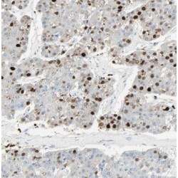 DNA Polymerase Iota (POLI) Antibody