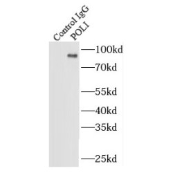 DNA Polymerase Iota (POLI) Antibody