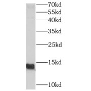 WB analysis of Transfected HEK-293 cells, using POLR3K antibody (1/1000 dilution).