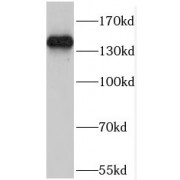 WB analysis of HeLa cells, using POM121 antibody (1/300 dilution).