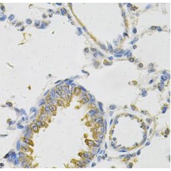 Serum Paraoxonase/arylesterase 2 (PON2) Antibody