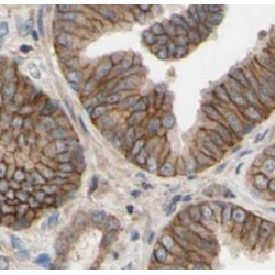 POTED-Specific Antibody