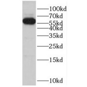 WB analysis of DU 145 cells, using POTEH antibody (1/300 dilution).