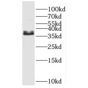 WB analysis of mouse lung tissue, using P11 antibody (1/600 dilution).