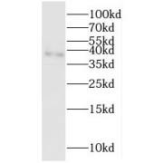WB analysis of mouse kidney tissue, using PPA2 antibody (1/1000 dilution).