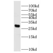 WB analysis of mouse skeletal muscle tissue, using PPAPDC3 antibody (1/800 dilution).