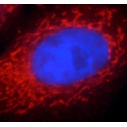 Peroxisome Proliferator Activated Receptor Gamma (PPARG) Antibody