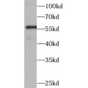 WB analysis of K-562 cells, using PPARG antibody (1/1000 dilution).