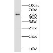 WB analysis of K-562 cells, using PPARG antibody (1/1000 dilution).