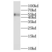 WB analysis of human stomach tissue, using PPAT antibody (1/500 dilution).