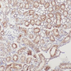 Phosphopantothenate--Cysteine Ligase (PPCS) Antibody