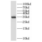 WB analysis of HeLa cells, using PPCS antibody (1/500 dilution).