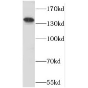 WB analysis of mouse brain tissue, using PPFIA3 antibody (1/600 dilution).