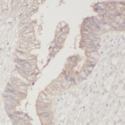 PPFIA Binding Protein 1 (PPFIBP1) Antibody