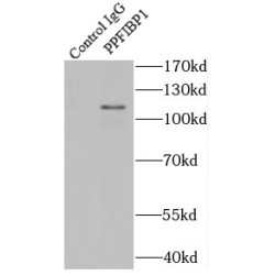 PPFIA Binding Protein 1 (PPFIBP1) Antibody