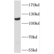 WB analysis of HepG2 cells, using PPFIBP1 antibody (1/1000 dilution).