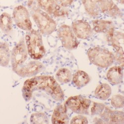 Protein Phosphatase, Mg2+/Mn2+ Dependent 1L (PPM1L) Antibody