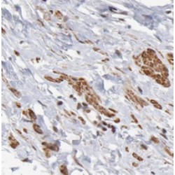PPP1CB-Specific Antibody