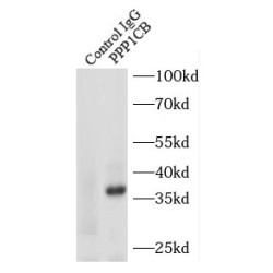 PPP1CB-Specific Antibody