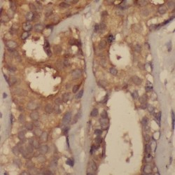 RelA-Associated Inhibitor (PPP1R13L) Antibody