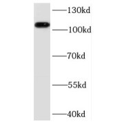 WB analysis of human heart tissue, using PPP1R13L antibody (1/200 dilution).
