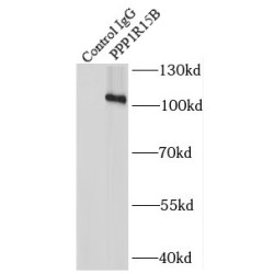 Protein Phosphatase 1 Regulatory Subunit 15B (PPP1R15B) Antibody