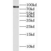 WB analysis of SMMC-7721 cells, using PPP1R3F antibody (1/1000 dilution).