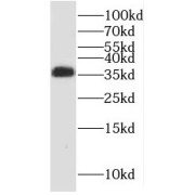 WB analysis of mouse lung tissue, using PPP2CB antibody (1/400 dilution).