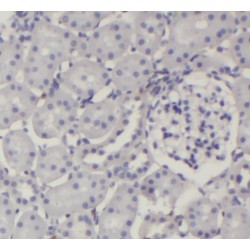 Serine/Threonine-Protein Phosphatase 2A 56 kDa Regulatory Subunit Alpha Isoform (PPP2R1A) Antibody