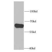 WB analysis of SW480 cells, using PPP2R1B antibody (1/1000 dilution).
