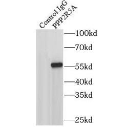 Serine / Threonine-Protein Phosphatase 2A 56 kDa Regulatory Subunit Alpha Isoform (PPP2R5A) Antibody