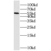 WB analysis of Human Ileum tissue, using PPP2R5A antibody (1/400 dilution).