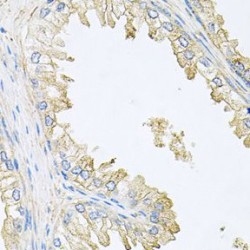 Calcineurin Subunit B Type 1 (PPP3R1) Antibody