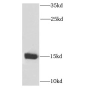 WB analysis of K-562 cells, using PPP3R1 antibody (1/1000 dilution).