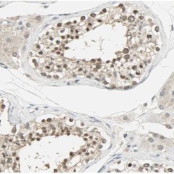 Calcineurin Subunit B Type 2 (PPP3R2) Antibody