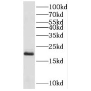 WB analysis of mouse testis tissue, using PPP3R2 antibody (1/500 dilution).