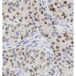 Protein Regulator of Cytokinesis 1 (PRC1) Antibody