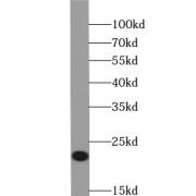 WB analysis of HeLa cells, using PRDX1 antibody (1/1000 dilution).