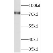 WB analysis of human brain tissue, using PREPL antibody (1/400 dilution).