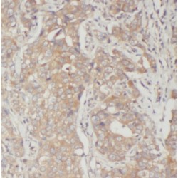 Bone Marrow Proteoglycan (PRG2) Antibody
