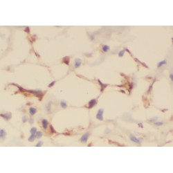Protein Kinase C Delta-Binding Protein (PRKCDBP) Antibody