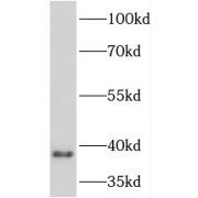 WB analysis of mouse lung tissue, using PRKCDBP antibody (1/400 dilution).