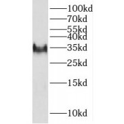 WB analysis of human skeletal muscle tissue, using Prnd antibody (1/1000 dilution).