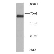 WB analysis of mouse liver tissue, using PRODH antibody (1/1000 dilution).