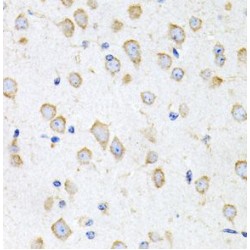 Prokineticin 2 / PK2 (PROK2) Antibody