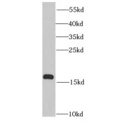 WB analysis of HepG2 cells, using PROK2 antibody (1/1000 dilution).